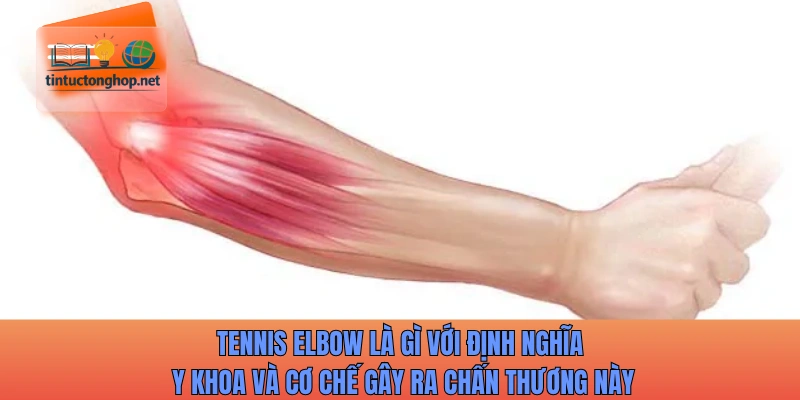 Tennis elbow là gì với định nghĩa y khoa và cơ chế gây ra chấn thương này